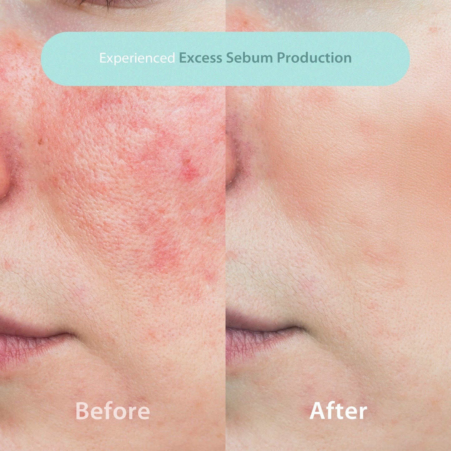 Pressed Serum (Crystal Iceplant)